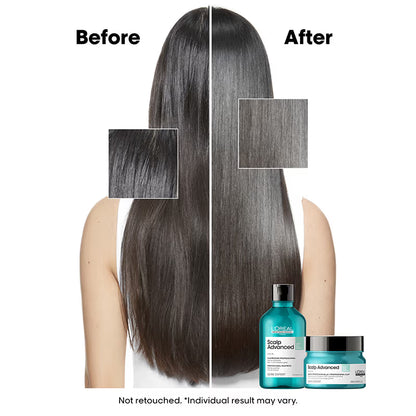 L’Oréal Professionnel Scalp Advanced Anti-Oiliness Dermo-Purifier Shampoo-for Oily Scalps(300ML)
