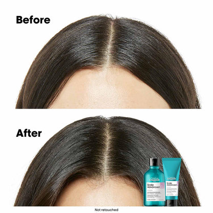 L’Oréal Professionnel Scalp Anti-Discomfort Dermo-Regulator Shampoo (300 ml) for Sensitive Scalp