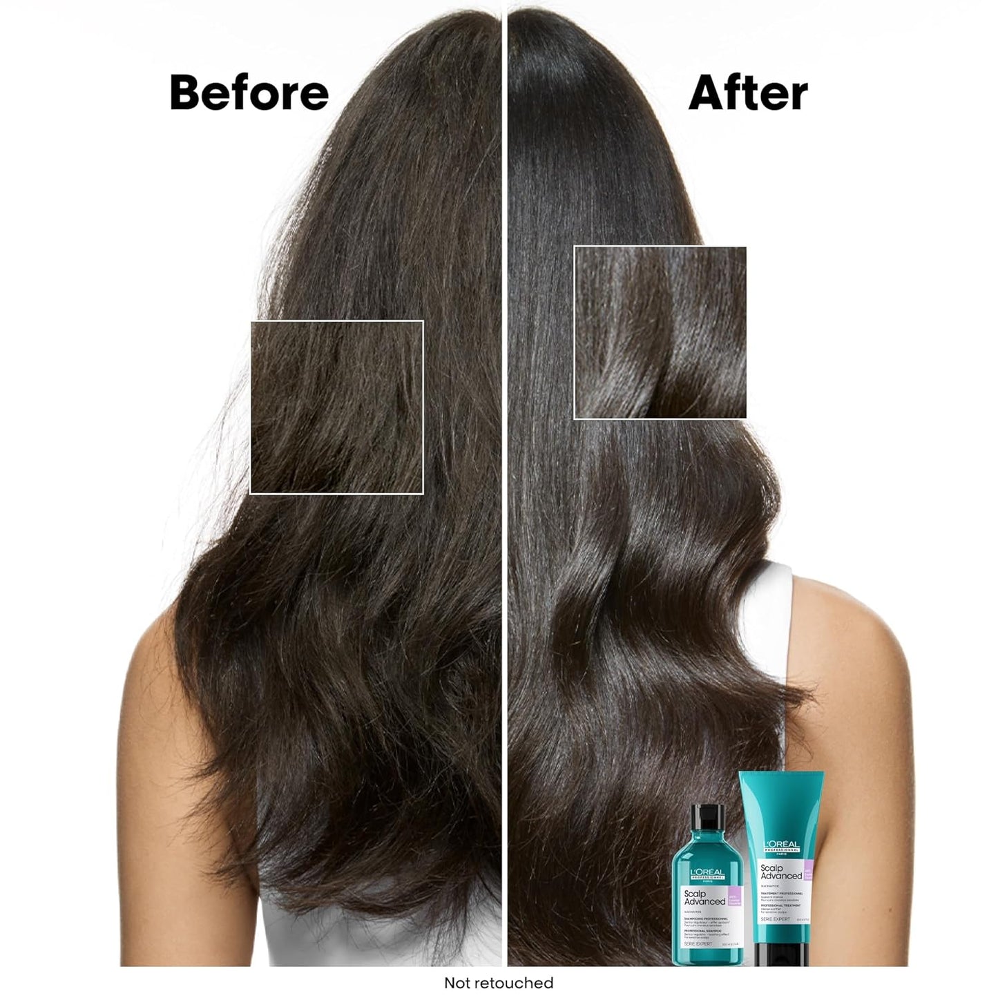 L’Oréal Professionnel Scalp Anti-Discomfort Dermo-Regulator Shampoo (300 ml) for Sensitive Scalp