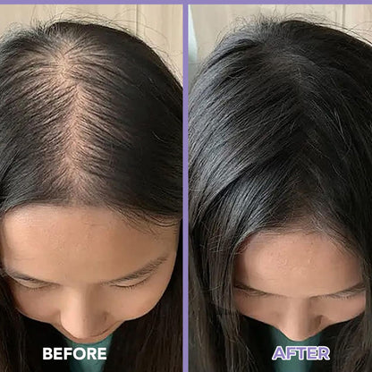 SPRING H2O Rosemary Hair Growth Oil