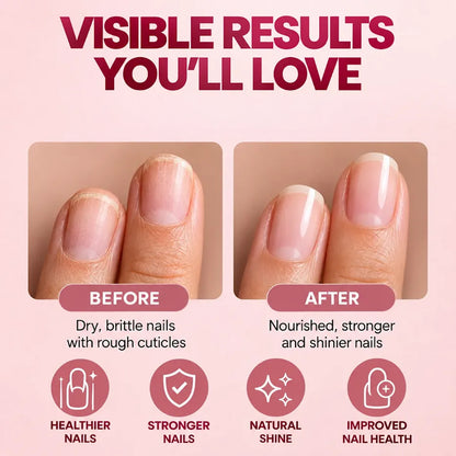 Spring H2O Nail Heal Cuticle Growth and Repair Oil before and after results for stronger, shinier and healthier nails